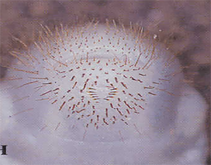 Patrón de pelos en forma de “V” en la región anal de la larva del escarabajo japonés.